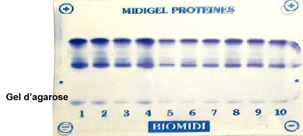 gel_agarose-1024x459 Électrophorèse